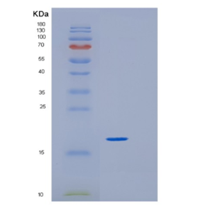 Recombinant Human GREM1 Protein,Recombinant Human GREM1 Protein