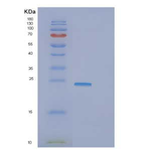 Recombinant Human GNPNAT1 Protein,Recombinant Human GNPNAT1 Protein