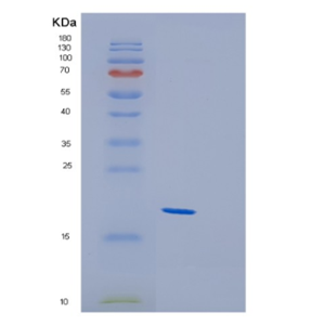 Recombinant Human GREM2 Protein,Recombinant Human GREM2 Protein