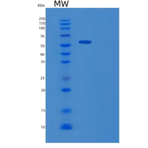 Recombinant Mouse Gpt Protein