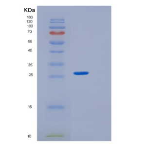 Recombinant Human GRB2 Protein