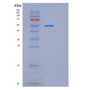 Recombinant Human GSS Protein,Recombinant Human GSS Protein