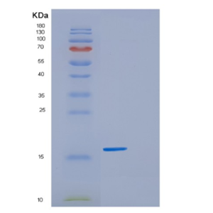 Recombinant Human GSKIP Protein,Recombinant Human GSKIP Protein