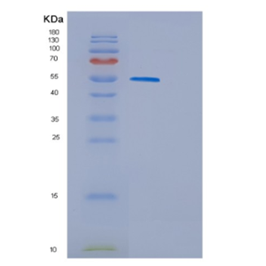 Recombinant Human GSR Protein