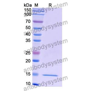 抗 Human RHOB 纳米抗体 (SAA1319)(RHF52801),Anti-Human RHOB Nanobody (SAA1319)