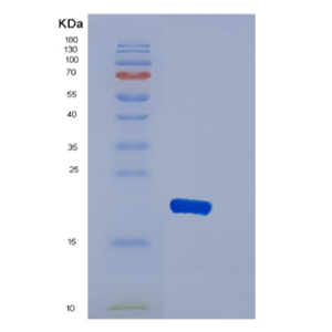 Recombinant Human DBNDD2 Protein
