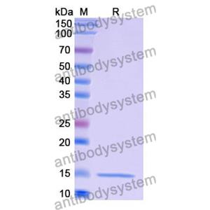 抗 Human LYZ 納米抗體 (SAA1052)(RHF45702),Anti-Human LYZ Nanobody (SAA1052)