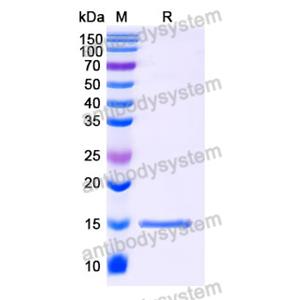 抗 SARS-CoV-2 S Protein 纳米抗体 (SAA1028)(RVV00143),Anti-SARS-CoV-2 S Protein Nanobody (SAA1028)