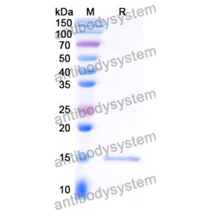 Anti-Clostridium botulinum botA/BOTOX Nanobody (SAA0936)