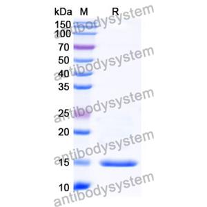 抗 Human C5 納米抗體 (SAA1365)(RHB90002),Anti-Human C5 Nanobody (SAA1365)