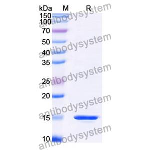 抗 Clostridium botulinum botA/BOTOX 納米抗體 (SAA0926)(RXX00906),Anti-Clostridium botulinum botA/BOTOX Nanobody (SAA0926)