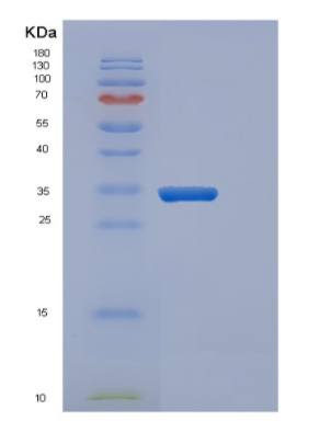 Recombinant Human CYB5R3 Protein,Recombinant Human CYB5R3 Protein
