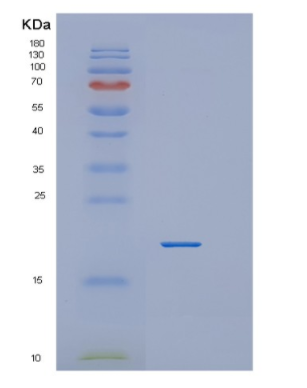 Recombinant Human Cyclophilin H(PPIH) Protein,Recombinant Human Cyclophilin H(PPIH) Protein