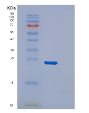 Recombinant Human Cysteine dioxygenase Protein,Recombinant Human Cysteine dioxygenase Protein