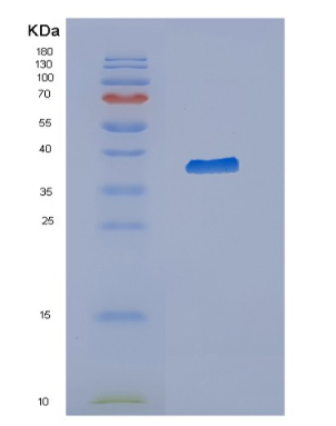 Recombinant Human CYTH3 Protein,Recombinant Human CYTH3 Protein