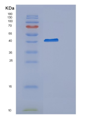 Recombinant Human CYTIP Protein,Recombinant Human CYTIP Protein