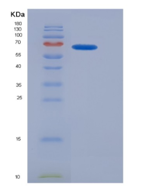 Recombinant Connective Tissue Growth Factor (CTGF),Recombinant Connective Tissue Growth Factor (CTGF)