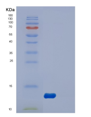 Recombinant Human DYNLL2 Protein,Recombinant Human DYNLL2 Protein