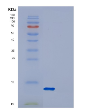 Recombinant Human DYNLRB2 Protein,Recombinant Human DYNLRB2 Protein