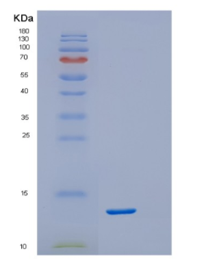 Recombinant Human DSCR1 isoform b Protein,Recombinant Human DSCR1 isoform b Protein