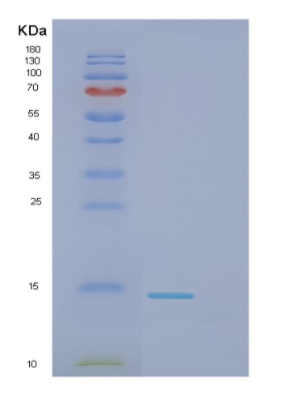 Recombinant Human DNAL4 Protein,Recombinant Human DNAL4 Protein