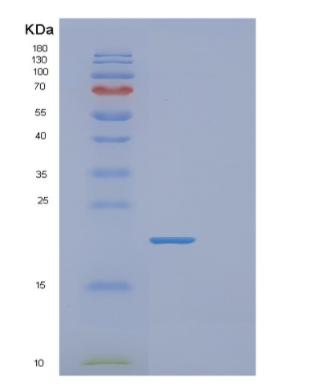 Recombinant Human FABP3 Protein,Recombinant Human FABP3 Protein