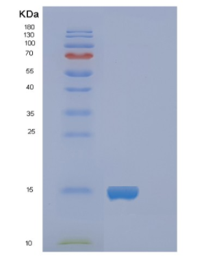 Recombinant Human FABP5 Protein,Recombinant Human FABP5 Protein