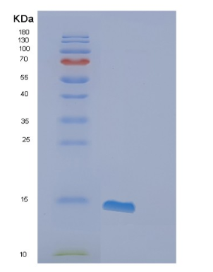 Recombinant Human FABP6 Protein,Recombinant Human FABP6 Protein