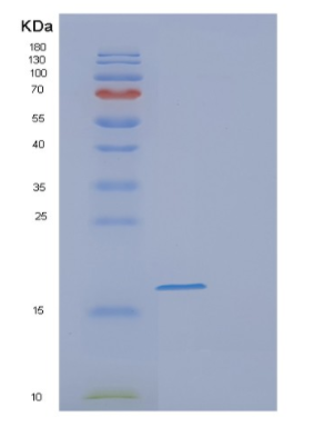 Recombinant Human FABP9 Protein,Recombinant Human FABP9 Protein