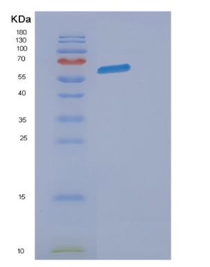 Recombinant Mouse Eogt Protein,Recombinant Mouse Eogt Protein
