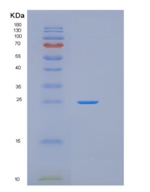 Recombinant Human GSTK1 Protein,Recombinant Human GSTK1 Protein