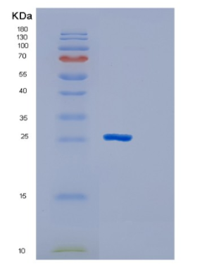 Recombinant Mouse GSTM1 Protein,Recombinant Mouse GSTM1 Protein