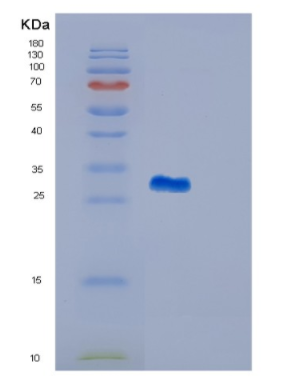 Recombinant Human GSTM4 Protein,Recombinant Human GSTM4 Protein