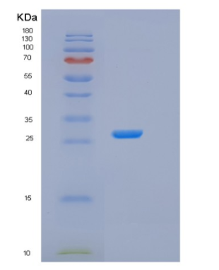 Recombinant Human GSTA4 Protein,Recombinant Human GSTA4 Protein