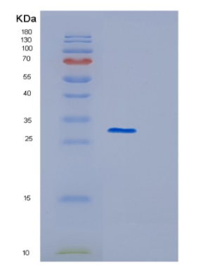 Recombinant Human GSTM3 Protein,Recombinant Human GSTM3 Protein