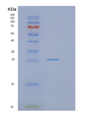 Recombinant Mouse Gstp1 Protein,Recombinant Mouse Gstp1 Protein