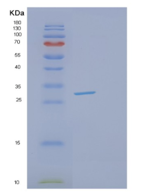 Recombinant Human GSTT2 Protein,Recombinant Human GSTT2 Protein