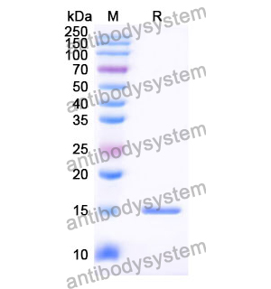 抗 Human SP140 纳米抗体 (SAA0901)(RHG49201),Anti-Human SP140 Nanobody (SAA0901)