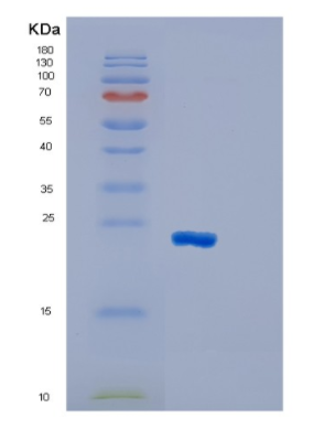 Recombinant Human GSTM1 Protein,Recombinant Human GSTM1 Protein