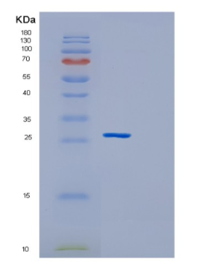 Recombinant Human GSTM2 Protein,Recombinant Human GSTM2 Protein