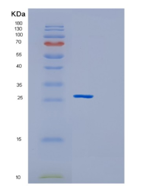 Recombinant Human GSTM5 Protein,Recombinant Human GSTM5 Protein