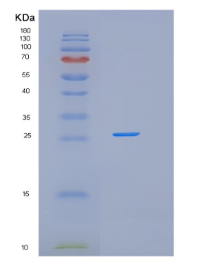 Recombinant Human GSTO1 Protein,Recombinant Human GSTO1 Protein