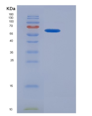 Recombinant General Transcription Factor IIA, Polypeptide 1 (GTF2A1),Recombinant General Transcription Factor IIA, Polypeptide 1 (GTF2A1)