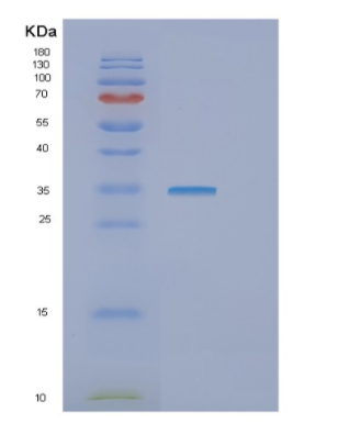 Recombinant Human GTF2E2 Protein,Recombinant Human GTF2E2 Protein