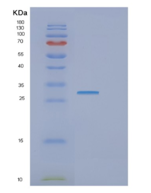 Recombinant Human GTF2F2 Protein,Recombinant Human GTF2F2 Protein