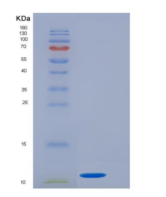 Recombinant General Transcription Factor IIH, Polypeptide 5 (GTF2H5),Recombinant General Transcription Factor IIH, Polypeptide 5 (GTF2H5)