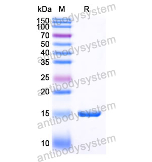 抗 Human KLB/Beta-klotho 納米抗體 (SAA1090)(RHJ17802),Anti-Human KLB/Beta-klotho Nanobody (SAA1090)