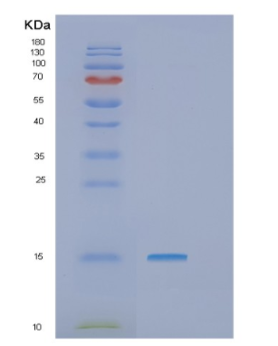 Recombinant Human GTLF3B Protein,Recombinant Human GTLF3B Protein