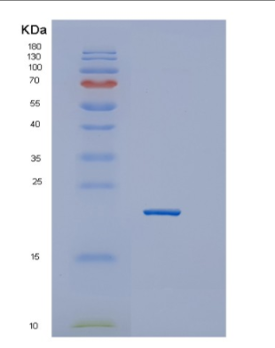 Recombinant Human GTSF1 Protein,Recombinant Human GTSF1 Protein