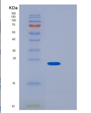 Recombinant Human GUK1 Protein,Recombinant Human GUK1 Protein